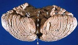 Human cerebellum anterior view description.JPG