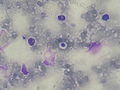 Cryptococcus smear MGG 2010-01-27.JPG