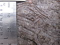 Lichen simplex chronicus 4.jpg