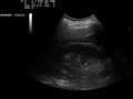 Ultrasound Scan ND 0110145312 1506110.png