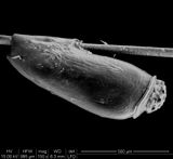 Louse egg attached to hair shaft of its host