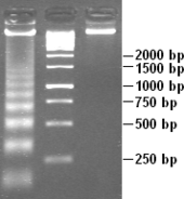 White DNA bands against a  dark grey background, resembling the rungs of a ladder