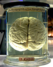 A brain floating in a liquid-filled glass jar. Yellowing of the handwritten labels on the jar give the object an antique appearance.