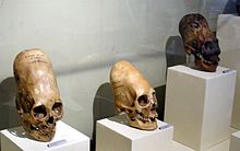 Paracas skulls in the  Museo Regional de Ica, Peru