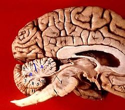 Human brain midsagittal view description.JPG