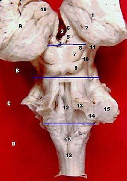Human brainstem-thalamus posterior view description.JPG