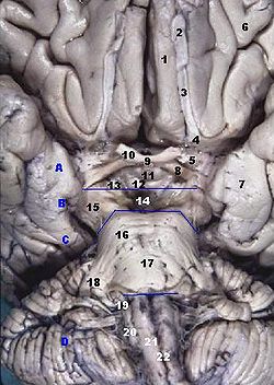 Human brainstem anterior view 2 description.JPG