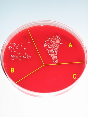 A Petri dish containing a red growth medium, and subdivided into three sectors, labelled A, B and C, respectively. There is a lot of visible microbial growth in culture A, some growth in culture B, and virtually no growth in culture C.