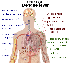 Outline of a human torso with arrows indicating the organs affected in the various stages of dengue fever