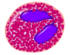Eosinophil 1.png