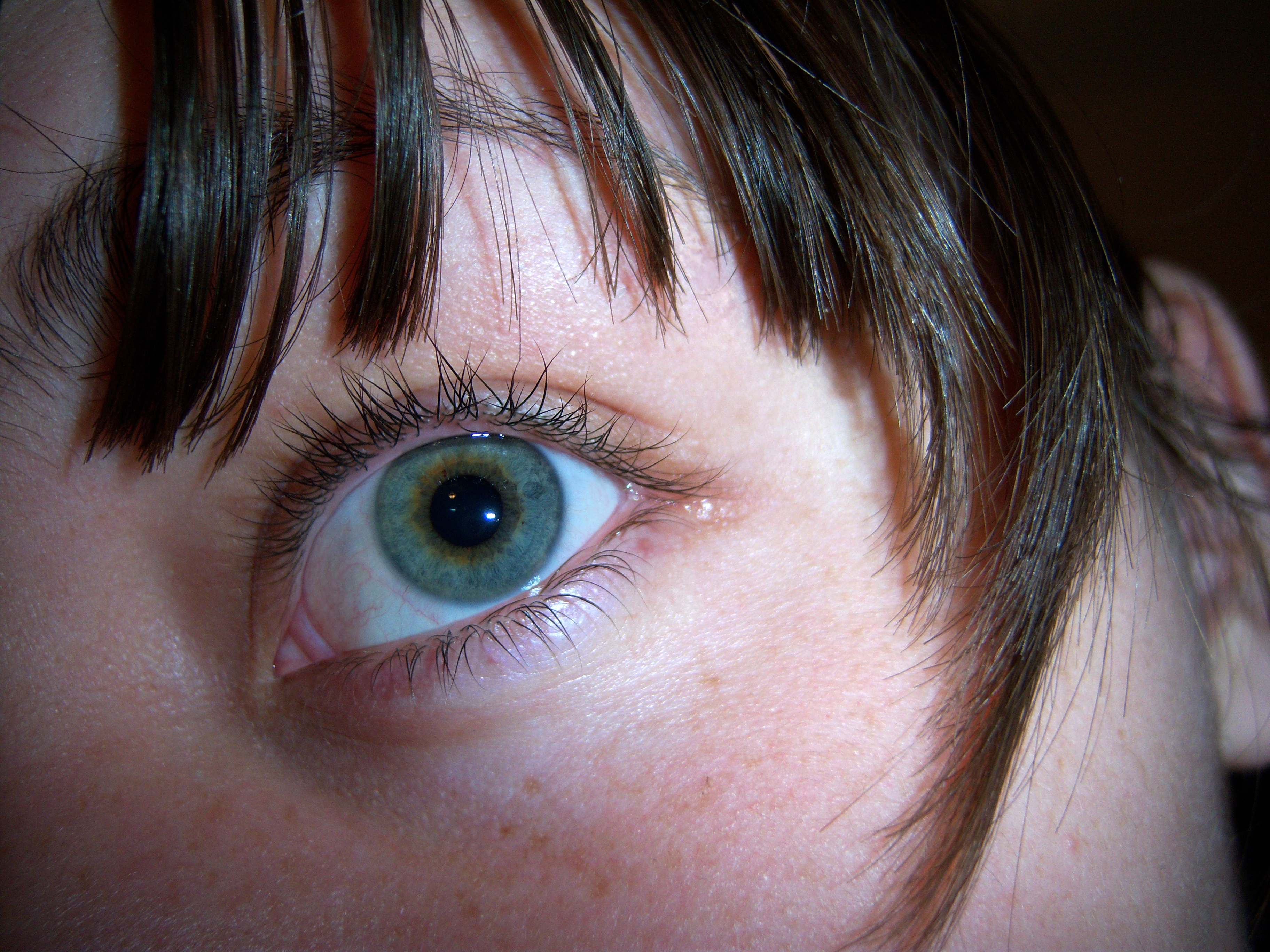 Как заболеть гетерохромией глаз в домашних условиях